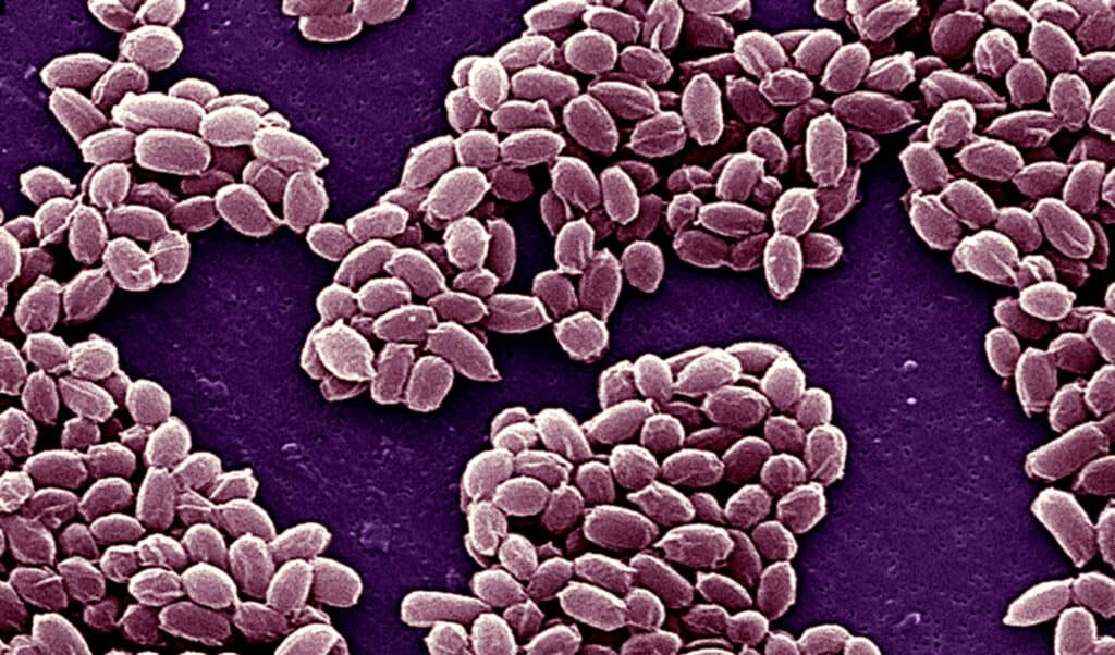 An electron micrograph of spores from the Sterne strain of Bacillus anthracis bacteria (anthrax). These spores can live for many years enabling the bacteria to survive in a dormant state.